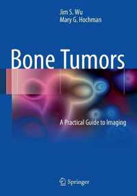 Bone Tumors