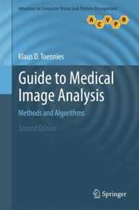 Guide to Medical Image Analysis: Methods and Algorithms