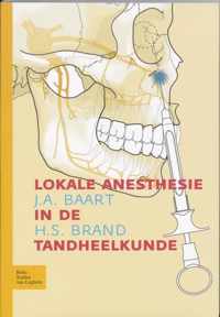 Lokale anesthesie in de tandheelkunde