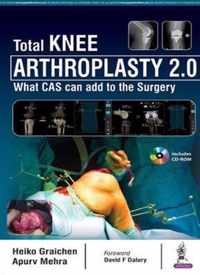 Total Knee Arthroplasty 2.0