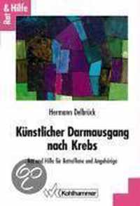 Kunstlicher Darmausgang Nach Krebs