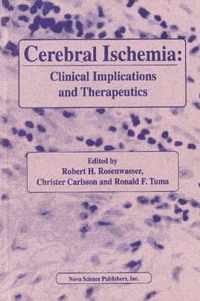 Cerebral Ischemia