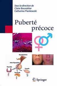 Puberte Precoce