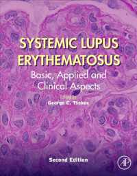 Systemic Lupus Erythematosus