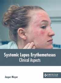 Systemic Lupus Erythematosus