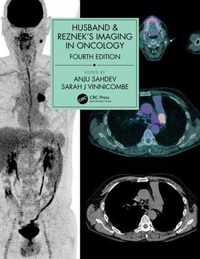 Husband & Reznek's Imaging in Oncology