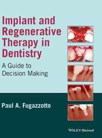 Implant and Regenerative Therapy in Dentistry