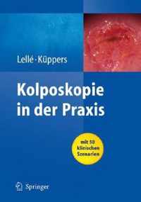 Kolposkopie in Der Praxis