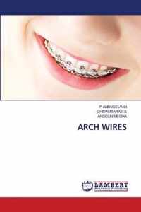 Arch Wires