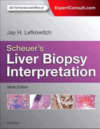 Scheuer's Liver Biopsy Interpretation