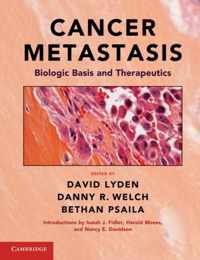 Cancer Metastasis