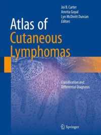 Atlas of Cutaneous Lymphomas