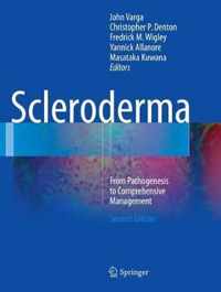 Scleroderma