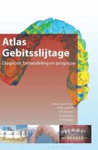 Atlas gebitsslijtage