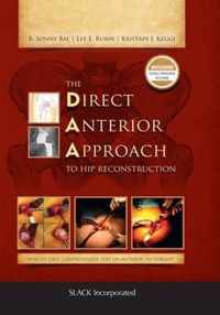 The Direct Anterior Approach to Hip Reconstruction