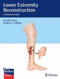 Lower Extremity Reconstruction