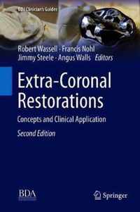 Extra Coronal Restorations