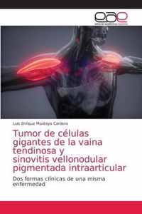 Tumor de celulas gigantes de la vaina tendinosa y sinovitis vellonodular pigmentada intraarticular