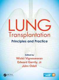 Lung Transplantation