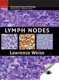 Lymph Nodes