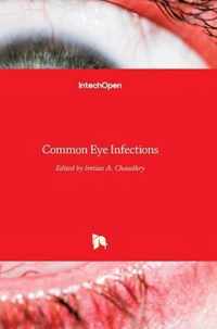 Common Eye Infections