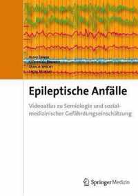 Epileptische Anfalle