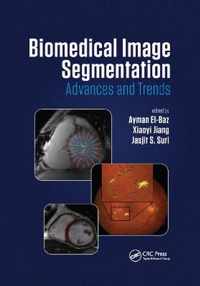 Biomedical Image Segmentation