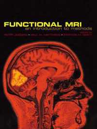 Functional Magnetic Resonance Imaging