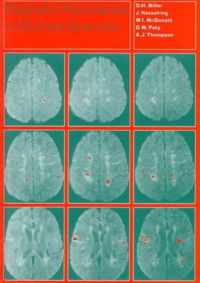 Magnetic Resonance in Multiple Sclerosis