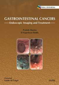 Gastrointestinal Cancers