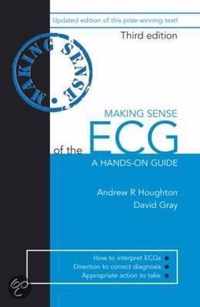 Making Sense of the ECG