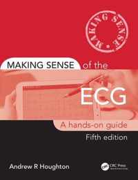 Making Sense of the ECG: A Hands-On Guide