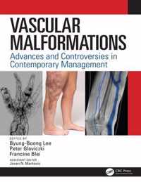 Vascular Malformations