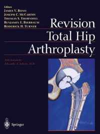 Revision Total Hip Arthroplasty