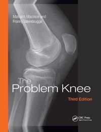 The Problem Knee