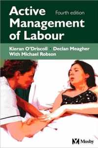 Active Management of Labour