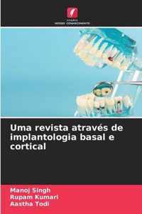 Uma revista atraves de implantologia basal e cortical