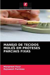 Manejo de Tecidos Moles Em Proteses Parciais Fixas