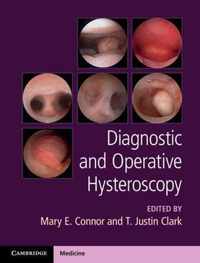 Diagnostic and Operative Hysteroscopy