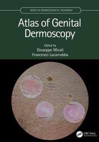 Atlas of Genital Dermoscopy