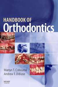 Handbook Of Orthodontics