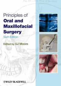 Principles Oral & Maxillofacial Surgery