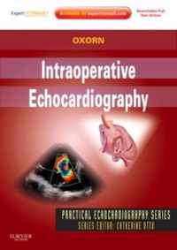 Intraoperative Echocardiography