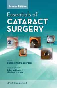 Essentials of Cataract Surgery