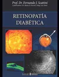 Retinopatia diabetica