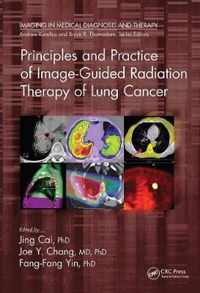 Principles and Practice of Image-Guided Radiation Therapy of Lung Cancer