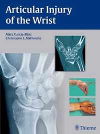 Articular Injury of the Wrist