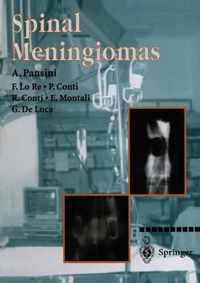 Spinal Meningiomas