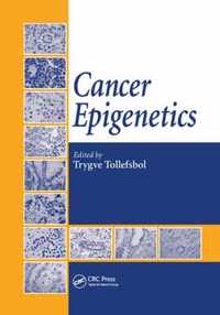 Cancer Epigenetics
