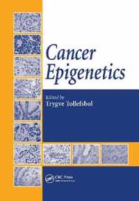 Cancer Epigenetics